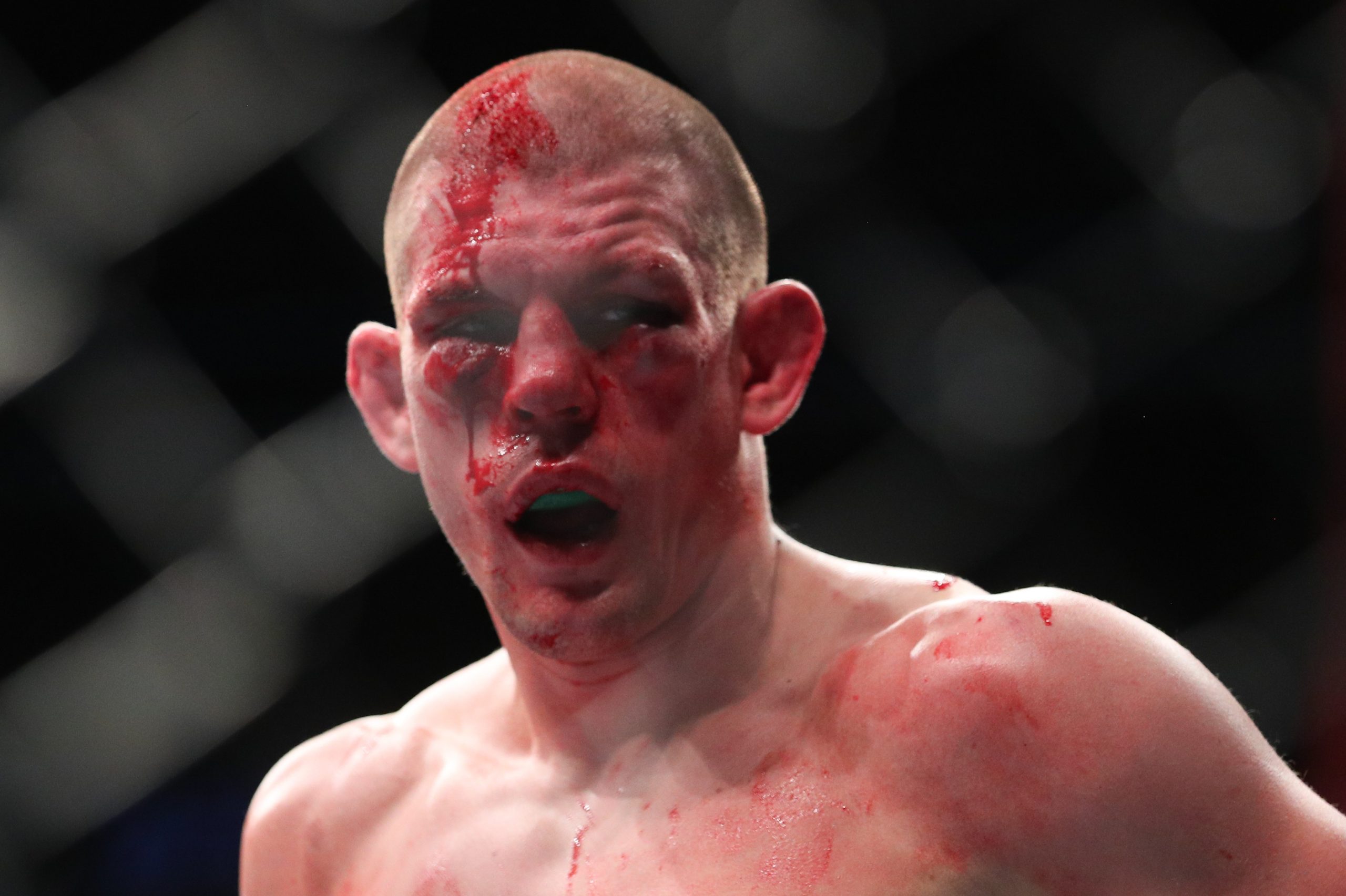 Joe Lauzon photo 3